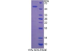 Image no. 1 for rho GDP Dissociation Inhibitor (GDI) beta (ARHGDIB) (AA 2-201) protein (His tag,GST tag) (ABIN6237345) (ARHGDIB Protein (AA 2-201) (His tag,GST tag))