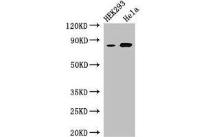 Western Blot Positive WB detected in: HEK293 whole cell lysate, Hela whole cell lysate All lanes: MELTF antibody at 3 μg/mL Secondary Goat polyclonal to rabbit IgG at 1/50000 dilution Predicted band size: 81, 33 kDa Observed band size: 81 kDa (MFI2 antibody  (AA 20-302))