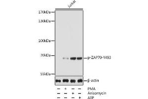 Western blot analysis of extracts of Jurkat cells using Phospho-ZAP70(Y493) Polyclonal Antibody at dilution of 1:5000. (ZAP70 antibody  (pTyr493))