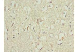 Immunohistochemistry of paraffin-embedded human brain tissue using ABIN7176117 at dilution of 1:100 (ZNF148 antibody  (AA 690-794))