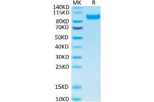 Human CDCP1 on Tris-Bis PAGE under reduced condition. (CDCP1 Protein (His tag))