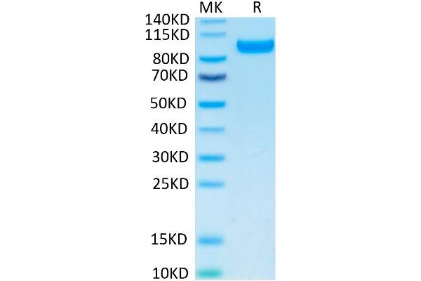 CDCP1 Protein (His tag)