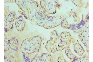 Immunohistochemistry of paraffin-embedded human placenta tissue using ABIN7145108 at dilution of 1:100 (ATG16L1 antibody  (AA 90-300))