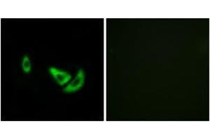 Immunofluorescence analysis of A549 cells, using DCT Antibody. (DCT antibody  (AA 51-100))