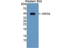 Detection of Recombinant PDE1A, Human using Polyclonal Antibody to Phosphodiesterase 1A, Calmodulin Dependent (PDE1A) (PDE1A antibody  (AA 2-318))