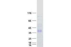 DHRS1 Protein (Transcript Variant 2) (Myc-DYKDDDDK Tag)