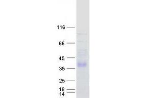 Validation with Western Blot (DHRS1 Protein (Transcript Variant 2) (Myc-DYKDDDDK Tag))