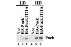 Neo, HA-Pnck and HA-Pnck T171A HEK-293 cells were plated at low (LD) and high (HD) cell density and lysates prepared after 48 hours. (PNCK antibody  (C-Term))