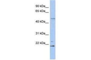 Image no. 1 for anti-Retinoblastoma Binding Protein 9 (RBBP9) (N-Term) antibody (ABIN6742511) (RBBP9 antibody  (N-Term))