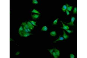 Immunofluorescence staining of MCF-7 cells with ABIN7162048 at 1:330, counter-stained with DAPI. (NME1 antibody  (AA 2-152))