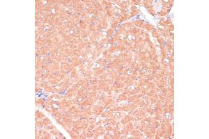 Immunohistochemistry of paraffin-embedded mouse heart using C antibody (ABIN7266010) at dilution of 1:100 (40x lens). (CACNB2 antibody  (AA 481-660))