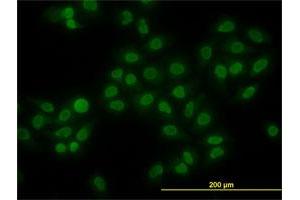 Immunofluorescence of monoclonal antibody to HMGB1 on HeLa cell. (HMGB1 antibody  (AA 1-90))