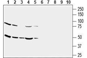 Western blot analysis of human U-87 MG glioblastoma cell line lysate (lanes 1 and 6), human THP-1 monocytic leukemia cell line lysate (lanes 2 and 7), human SH-SY5Y neuroblastoma cell line lysate (lanes 3 and 8), human MEG-01 megakaryoblastic leukemia cell line lysate (lanes 4 and 9) and human Jurkat T-cell leukemia cell line lysate (lanes 5 and 10): - 1-5. (SLC2A3 antibody  (1st Extracellular Loop))