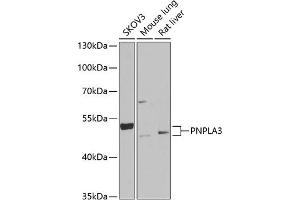 Western blot analysis of extracts of various cell lines, using PNPL Antibody (ABIN6132501, ABIN6145859, ABIN6145860 and ABIN6222404) at 1:1000 dilution. (PNPLA3 antibody  (AA 377-481))