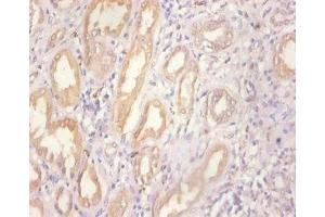 Immunohistochemistry of paraffin-embedded human kidney tissue using ABIN7159509 at dilution of 1:100 (MT1A antibody  (AA 1-59))