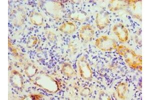 Immunohistochemistry of paraffin-embedded human kidney tissue using ABIN7154176 at dilution of 1:100 (GATM antibody  (AA 124-423))