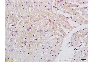 Formalin-fixed and paraffin embedded mouse heart labeled with Anti-MLK3/RHOE Polyclonal Antibody, Unconjugated (ABIN682573) at 1:200 followed by conjugation to the secondary antibody (MAP3K11 antibody  (AA 355-460))