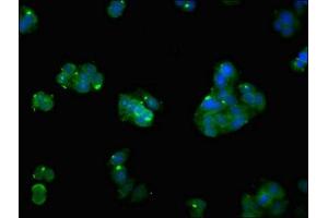 Immunofluorescent analysis of HepG2 cells using ABIN7168596 at dilution of 1:100 and Alexa Fluor 488-congugated AffiniPure Goat Anti-Rabbit IgG(H+L) (ATP2A1/SERCA1 antibody  (AA 384-579))