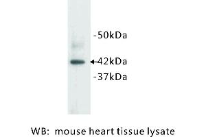 Image no. 1 for anti-Actin, Alpha, Cardiac Muscle 1 (ACTC1) antibody (ABIN1112792) (ACTC1 antibody)