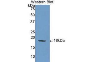Western Blotting (WB) image for anti-Selectin P (Granule Membrane Protein 140kDa, Antigen CD62) (SELP) (AA 58-195) antibody (ABIN1078521)