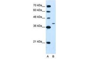 Image no. 1 for anti-Protein tyrosine Phosphatase, Non-Receptor Type 2 (PTPN2) (AA 23-72) antibody (ABIN205078) (PTPN2 antibody  (AA 23-72))