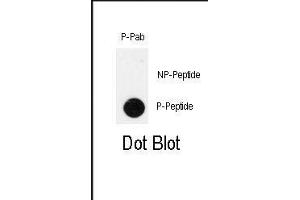 Image no. 1 for anti-Pancreatic and Duodenal Homeobox 1 (PDX1) (pThr11) antibody (ABIN358543) (PDX1 antibody  (pThr11))