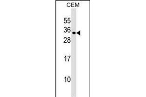 MXD1 Antibody (N-term) (ABIN1539192 and ABIN2848800) western blot analysis in CEM cell line lysates (35 μg/lane).