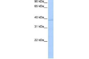 Human MCF-7; WB Suggested Anti-ANXA8L2 Antibody Titration: 0. (ANXA8L2 antibody  (N-Term))