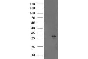 HEK293T cells were transfected with the pCMV6-ENTRY control (Left lane) or pCMV6-ENTRY AK4 (Right lane) cDNA for 48 hrs and lysed. (AK4 antibody)