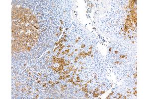 Immunohistochemistry (IHC) image for anti-CD38 (AA 43-300) antibody (ABIN7453961) (Recombinant CD38 antibody  (AA 43-300))