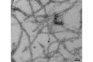 TEM of recombinant Tau (K18), P301L mutant Pre-formed Fibrils (PFFs) at 150kx magnification. (tau Protein (partial, Pro301Leu-Mutant))