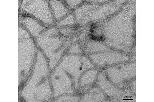 Electron Microscopy (EM) image for tau Protein (partial), (Pro301Leu-Mutant) (Active) protein (ABIN6929400)