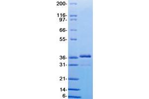 Validation with Western Blot (RSPO1 Protein)
