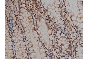 ABIN6268881 at 1/200 staining human colon tissue sections by IHC-P. (Desmin antibody)