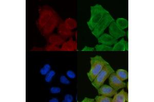 staining Hela cells(30 min of UV treatment) by IF/ICC. (PDE4B/C/D antibody)