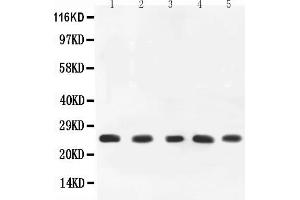 Anti-TNF alpha Picoband antibody, All lanes: Anti-TNF alpha at 0. (TNF alpha antibody  (AA 89-235))