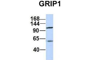 Host:  Rabbit  Target Name:  GRIP1  Sample Type:  Human Adult Placenta  Antibody Dilution:  1. (GRIP1 antibody  (C-Term))