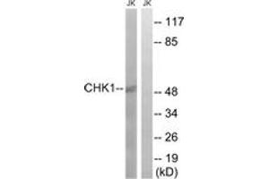 Western blot analysis of extracts from JurKat cells, using Chk1 (Ab-280) Antibody. (CHEK1 antibody  (AA 251-300))