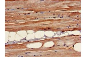 Immunohistochemistry of paraffin-embedded human skeletal muscle tissue using ABIN7145371 at dilution of 1:100 (B3GALT4 antibody  (AA 42-266))