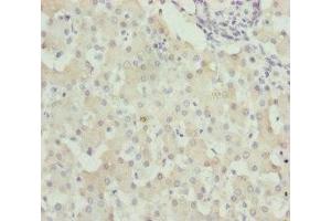 Immunohistochemistry of paraffin-embedded human liver tissue using ABIN7175709 at dilution of 1:100 (WDR45 antibody  (AA 1-360))