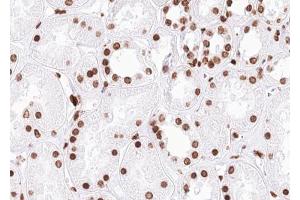 ABIN6267648 at 1/100 staining human kidney tissue sections by IHC-P.