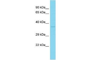 Host: Rabbit Target Name: LYSMD3 Sample Type: Fetal Kidney lysates Antibody Dilution: 1. (LYSMD3 antibody  (C-Term))