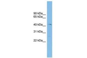 Image no. 1 for anti-Ets Variant 7 (ETV7) (AA 71-120) antibody (ABIN6744663) (ETV7 antibody  (AA 71-120))