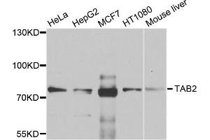 Western blot analysis of extracts of various cell lines, using TAB2 antibody. (TAB2 antibody)