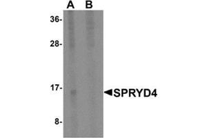 Western blot analysis of SPRYD4 in mouse kidney tissue lysate with SPRYD4 antibody at 1 μg/ml in (A) the absence and (B) the presence of blocking peptide.