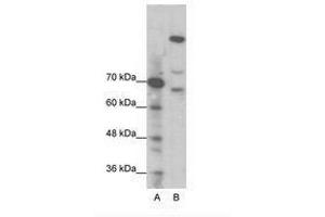 Image no. 1 for anti-Zinc Finger Protein GLI1 (GLI1) (N-Term) antibody (ABIN202973)