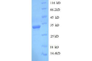 SDS-PAGE (SDS) image for delta-Like 1 Homolog (Drosophila) (DLK1) (AA 24-303) protein (His tag) (ABIN4974214)