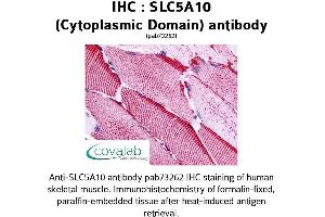 Image no. 1 for anti-Solute Carrier Family 5 (Sodium/glucose Cotransporter), Member 10 (SLC5A10) (Cytoplasmic Domain) antibody (ABIN1739393) (SLC5A10 antibody  (Cytoplasmic Domain))
