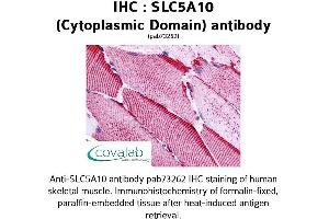 SLC5A10 anticorps  (Cytoplasmic Domain)