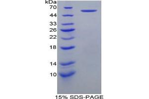 SDS-PAGE analysis of Mouse HSPD1 Protein. (HSPD1 Protein)